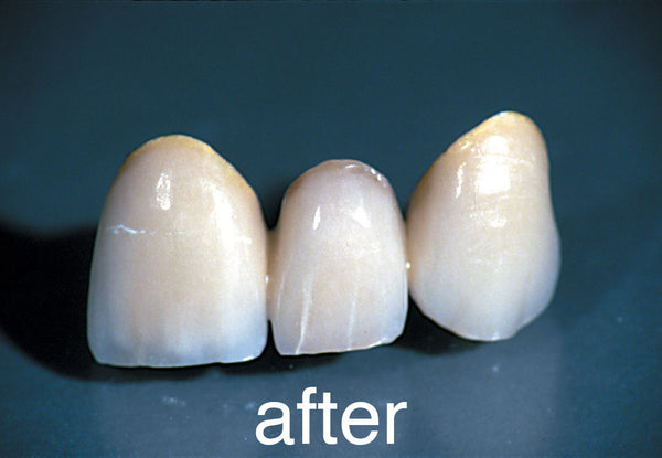 Diamond Rubber Wheel™