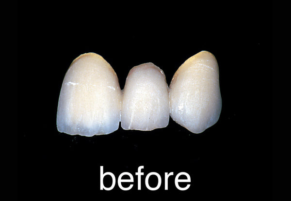 Diamond Rubber Wheel™